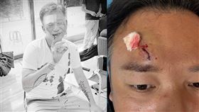 演員白吉勝（阿Ben）近日拍戲時不慎意外受傷，滿身是血送醫急救。（圖／翻攝自臉書）
