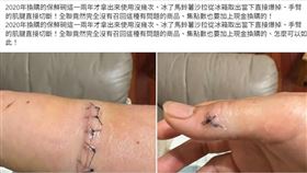 一名消費者在臉書社團「全聯消費經驗老實說」貼文，指稱換購的保鮮碗從冰箱取出當下爆掉，直接切斷手臂肌腱。（圖／翻攝自全聯消費經驗老實說）