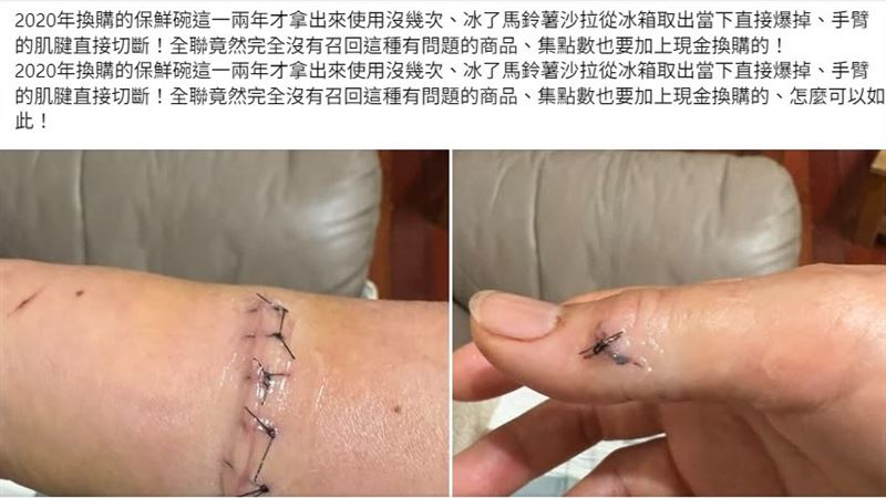 換購保鮮盒割斷手臂肌腱　全聯致歉聲明曝