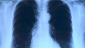 肺臟（示意圖／PIXABAY）