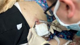 聯醫中興院區伍智杰醫師細心地於床邊執行清創。（圖／北市聯醫提供）