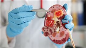 腎臟、腎病、洗腎 示意圖／unsplash