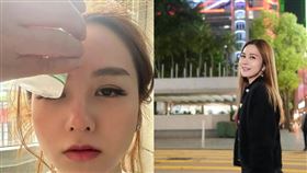 梁茵燙傷當下緊急冰敷。（圖／翻攝自IG）