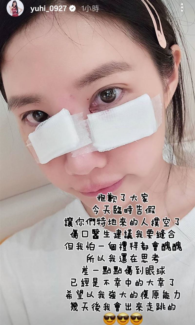 筠熹坦言醫生有建議縫合傷口。（圖／翻攝自筠熹IG）
