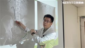 久坐少喝水代價很慘！他2年3度腎結石（圖／翻攝畫面）