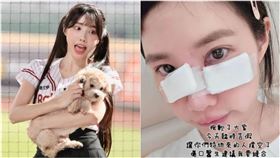 筠熹坦言醫生有建議縫合傷口。（圖／翻攝自筠熹IG）