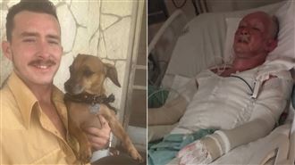 為救愛犬！男衝回火場「40％皮膚被燒爛」