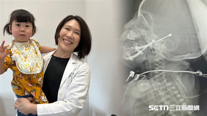 獨／全台她才會的手術！她不走醫美賺錢