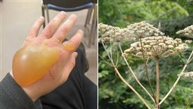 世界第一危險猛毒植物，入侵北海道，一摸手腫巨大水泡，「巨型霍格威德」（Giant Hogweed）(圖／翻攝自川崎映臉書)