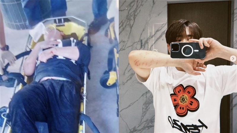 男星爆失足墜海　他曝傷勢：請勿任何揣測