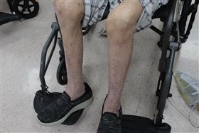 肌少症。（圖／衛福部彰化醫院）