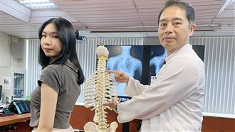 脊椎側彎像蜈蚣！21歲女術後矯正長高8CM