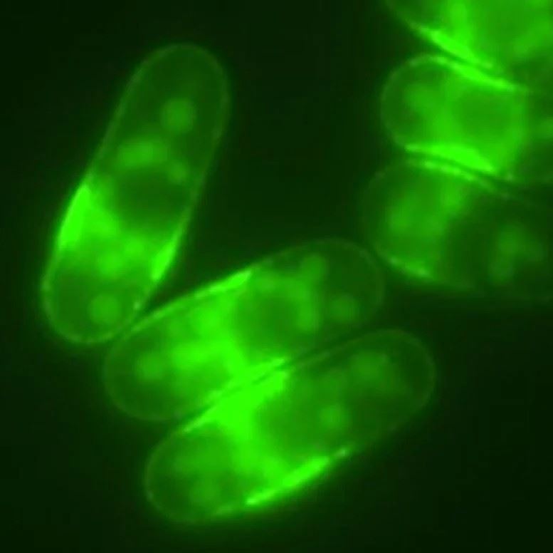 裂殖酵母細胞中的葡萄糖轉運蛋白Ght5被綠色螢光蛋白(GFP)螢光標記。(圖/倫敦瑪麗皇后大學)