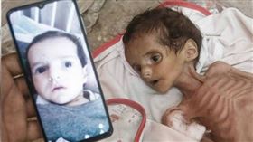 加薩地區出生不到6個月的嬰兒營養不良死亡，讓家屬相當悲痛。（圖／翻攝自臉書／TRT World）