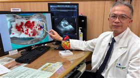 鄭伊佐醫師說明，心臟黏液瘤為良性腫瘤，像果凍般在心臟內擺動，會引發血栓，以中風症狀做表現，只要妥善治療預後都能良好。（圖／台中慈濟醫院提供） 