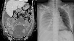 消化內科醫師謝文斌臉書