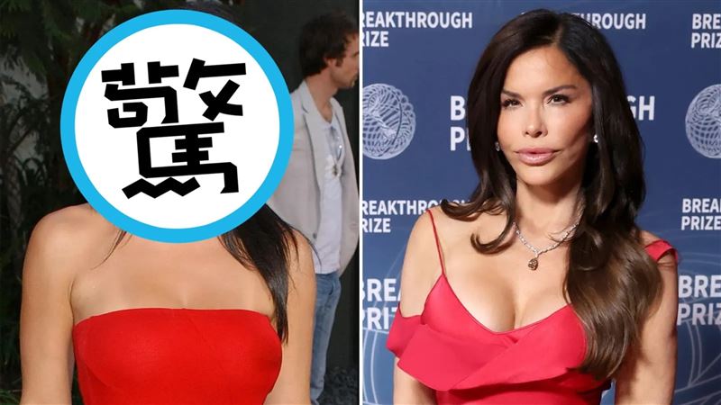 貝佐斯妻整形前照曝！醫：臉頰把眼睛擠歪