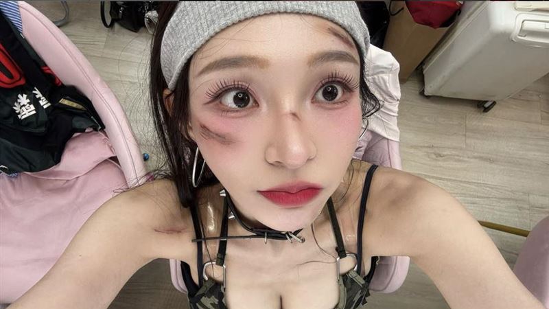 林襄曝受傷照！美腿「皮開肉綻」嚇壞粉絲