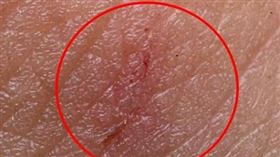 ▲基隆罷團領銜人陳青逸遭婦人動手致傷（圖／翻攝自基隆絕沛threads）