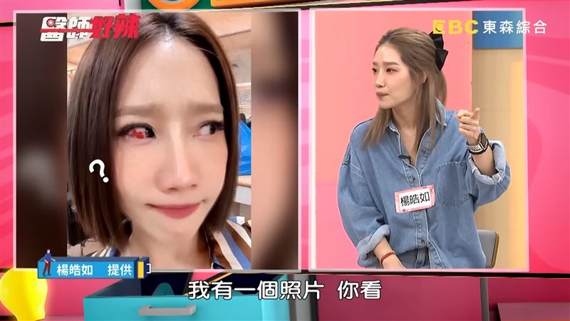 楊皓如眼睛爆血輪眼。（圖／翻攝自醫師好辣YouTube）