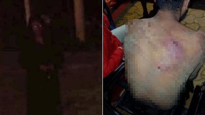 傳少年見「黑衣哭泣女」被爪傷…背留血痕