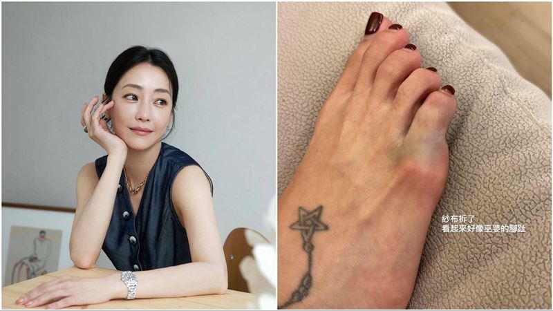 謝欣穎驚傳骨折　原因竟是兒子釀禍