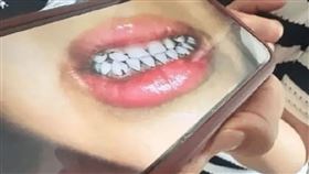 ▲鉛中毒讓孩童牙齒黑。翻攝自網路