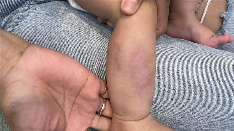 桃園保母涉虐嬰 父母淚:看重護理師背景