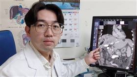 初期無症狀，6旬男膚發黃，茶色尿，黃疸，膽管癌(圖／大千醫院提供)