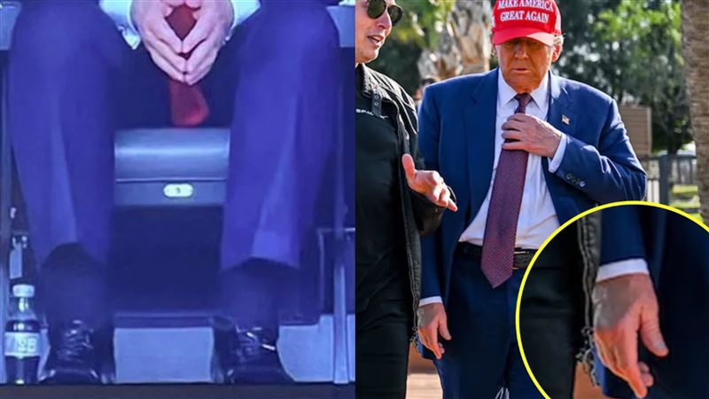 川普「腿腫瘀青」健康出狀況？她這樣走的