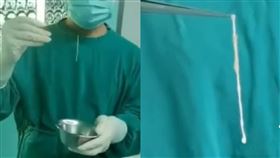 37歲男突不會說話！醫開顱夾出「10公分活蟲」曝元兇：嚴重恐喪命。（圖／翻攝自廣州日報）