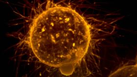 癌症、癌細胞、低醣飲食 示意圖／unsplash