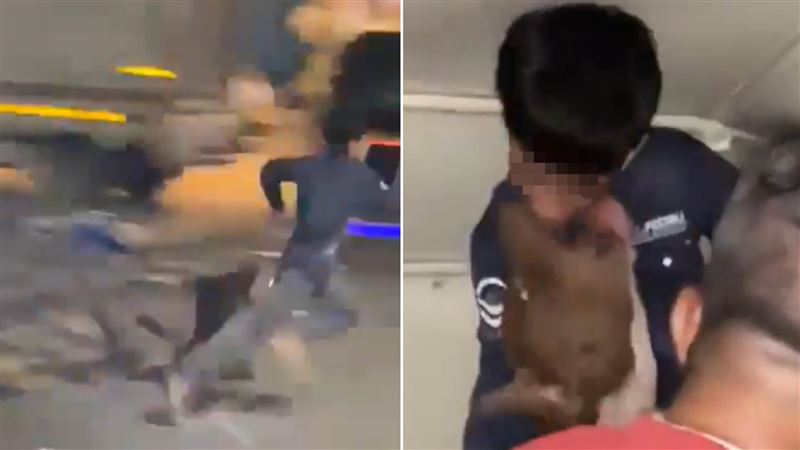 被比特犬咬臉!11歲求助 飼主不幫還笑他