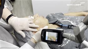 亞洲人皮膚色素困擾多　治療技術再進化