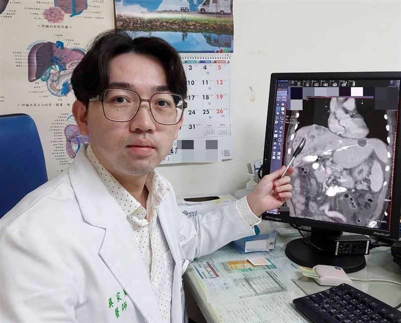 吳家慶醫師表示,因病人膽汁無法排出,故以引流術將滯留膽汁排出,降低黃疸指數。(圖/大千綜合醫院提供)
