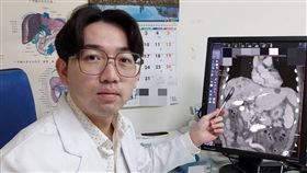吳家慶醫師表示，因病人膽汁無法排出，故以引流術將滯留膽汁排出，降低黃疸指數。（圖／大千綜合醫院提供） 