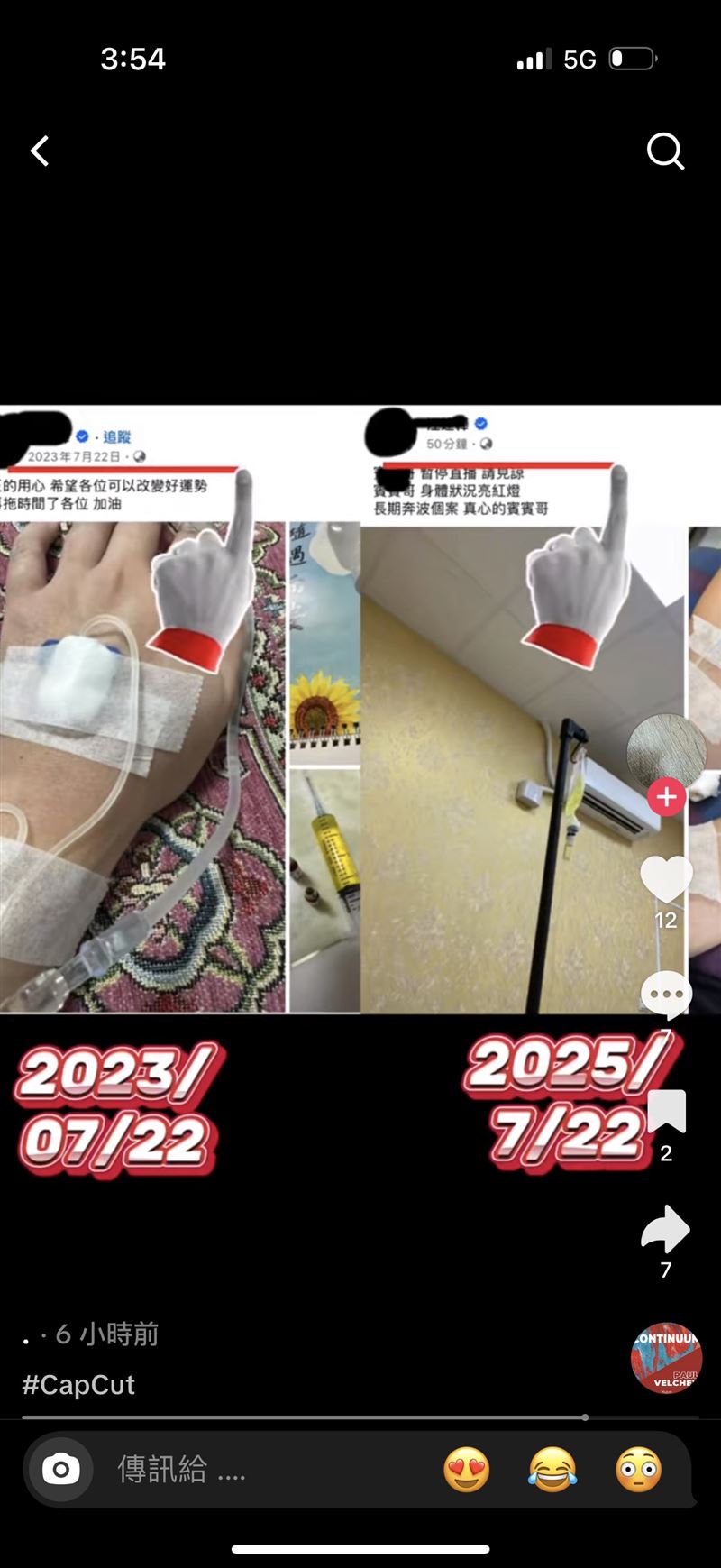 圤智雨提供畫面打臉賓賓哥,指其有打美白針的習慣。(圖/圤智雨提供)