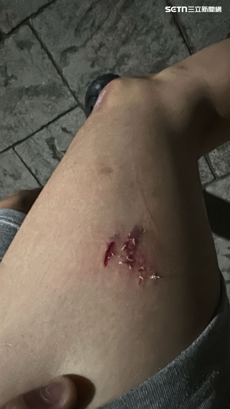 男子騎車經過熱炒店被店狗咬傷,再度經過時又發現狗未繫繩讓他氣炸。(圖/翻攝畫面)
