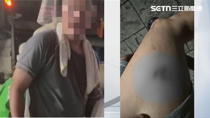 台中騎士遭到狗狗追咬,大腿皮開肉綻。(圖/翻攝畫面)