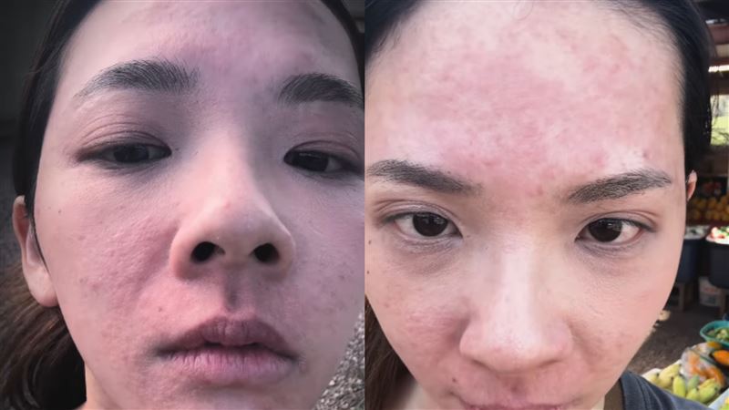 滴妹騎馬初體驗超慘。(圖/翻攝自滴妹IG)