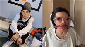 阿Mo受傷之後首度露臉。（圖／翻攝自IG）