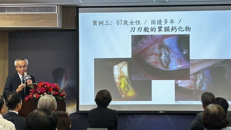 陳俊良醫師分享角膜修復個案。(圖/記者簡浩正攝影)