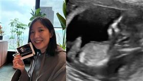 Sandra開心分享初期超音波照片，感性告白：「你還沒出生，媽媽爸爸就已經非常愛你了。」（圖／翻攝自IG）