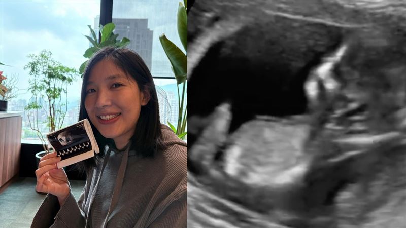 44歲Sandra宣布懷孕！領畢業證書當場哭了