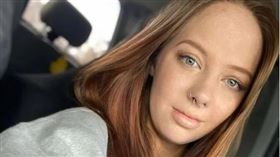 ▲艾比6年前遇上氣爆，經手術與復健後，如今幾乎看不出傷口。（圖／翻攝Reddit）