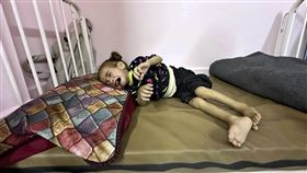 ▲5月18日，一名兒童因營養不良在加薩一處醫院病床上哭泣。（圖／美聯社／達志影像）