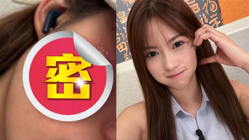 甜美女星敷面膜毀容！臉上像「十級火災」