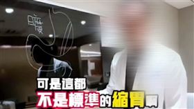 衛生局,高雄,手術,醫師,家屬,網紅,費用,縮胃,減重