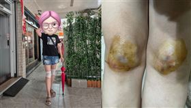 陳思安重摔。（圖／翻攝自臉書）