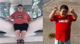 中國男孩壯壯是「小胖威利綜合症」患者。（圖／翻攝自微博）